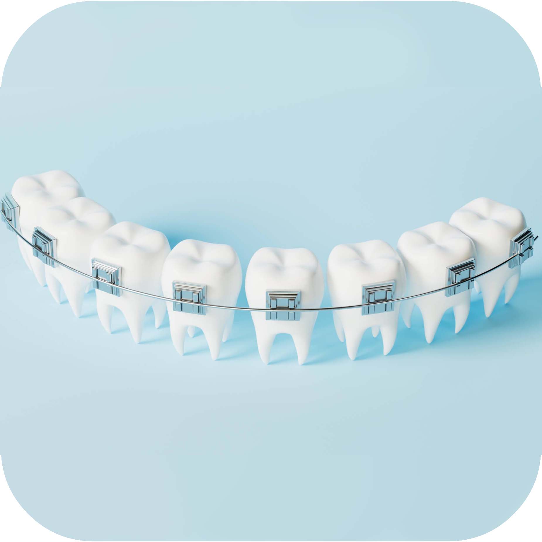 براکت و باکال تیوب