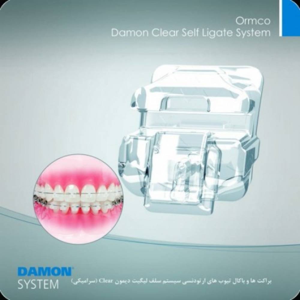 براکت سرامیکی کلیر دیمون