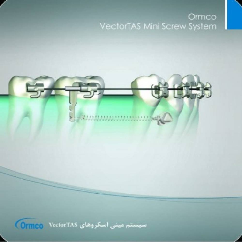 پیچ مینی اسکرو